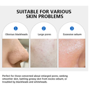 Dupe Medicube - Poro Zero Lakerain - Zero Pore Pad 2.0 com Fórmula Dupla para Menos Poros