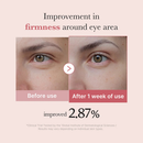 Medicube Creme Área Dos Olhos Peptídeo Rosa Pdrn 30ml